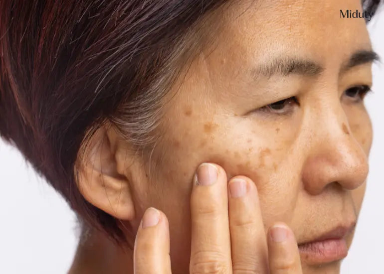 Drug Induced Pigmentation: Causes, Diagnosis and Treatments