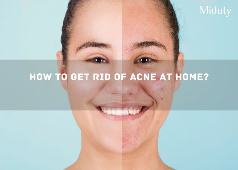 How to Get Rid of Acne at Home?