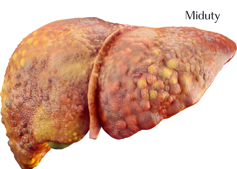14 Warning Signs of Liver Damage From Alcohol Backed by Science