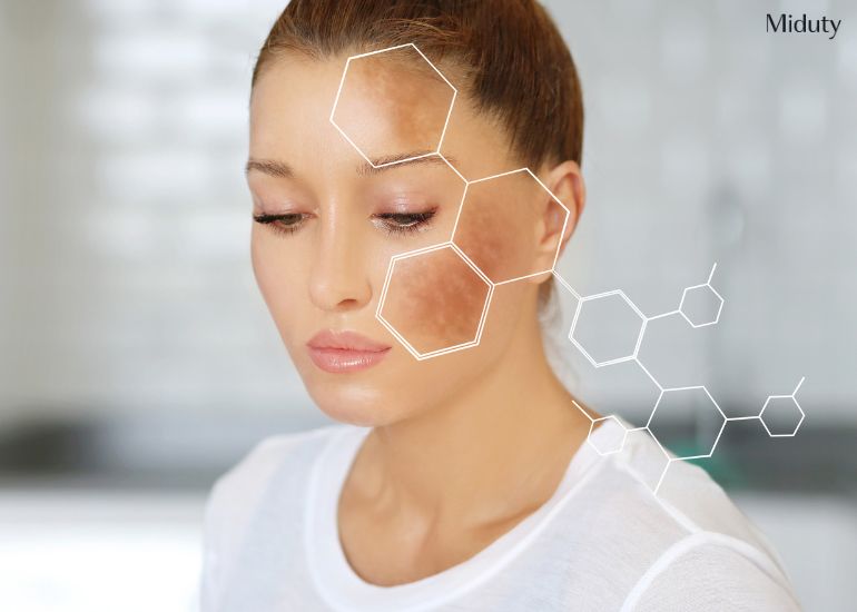 Hyperpigmentation: Causes, Types, Treatments