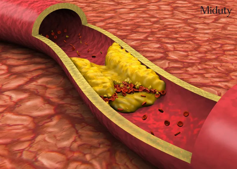 Link Between Cholesterol and Liver