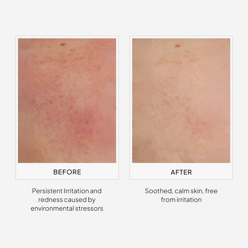 Before and After of Using EpiShield (Skin Brightening Serum)