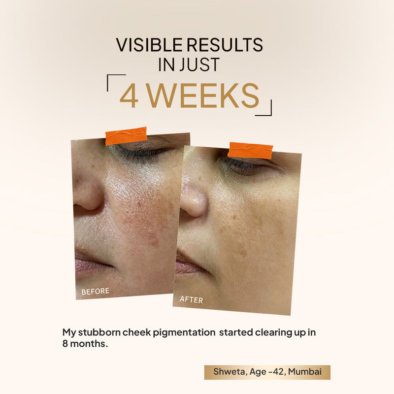 Visible results in just 4 weeks